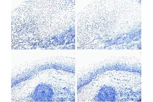 Rb (pS780) staining on tonsil. (Retinoblastoma 1 antibody  (pSer780))
