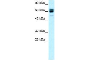 WB Suggested Anti-RNF12 Antibody Titration:  0. (RLIM antibody  (C-Term))
