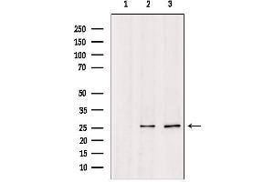 Western blot analysis of extracts from various samples, using TSPAN8 Antibody. (Tspan-8 antibody  (Internal Region))