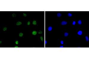 A549 cells were stained with IRF2 (5F2) Monoclonal Antibody  at [1:200] incubated overnight at 4C, followed by secondary antibody incubation, DAPI staining of the nuclei and detection. (IRF2 antibody)