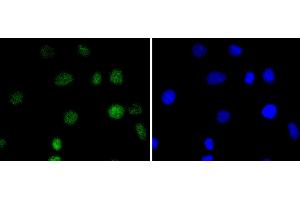 A549 cells were stained with IRF2 (5F2) Monoclonal Antibody  at [1:200] incubated overnight at 4C, followed by secondary antibody incubation, DAPI staining of the nuclei and detection.