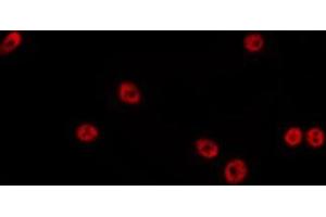 ABIN6275129 staining HepG2 by IF/ICC. (FOXD4L1 antibody)