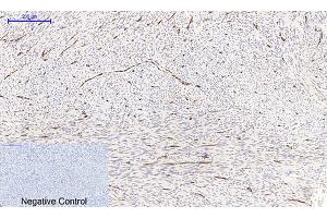 Immunohistochemical analysis of paraffin-embedded human uterus tissue. (NF-kB p65 antibody  (pSer536))