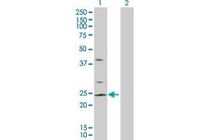 Western Blot analysis of RHOC expression in transfected 293T cell line by RHOC MaxPab polyclonal antibody.