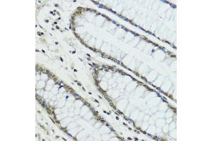 Immunohistochemistry of paraffin-embedded human colon using TRIP12 antibody (ABIN6129753, ABIN6149543, ABIN6149544 and ABIN6225295) at dilution of 1:100 (40x lens).