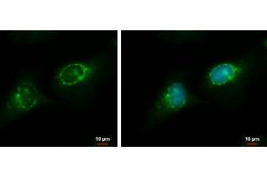 ICC/IF Image RGS7 antibody detects RGS7 protein at endoplasmic reticulum by immunofluorescent analysis. (RGS7 antibody)