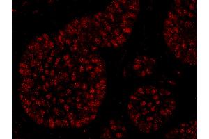 Immunofluorescence (IF) image for anti-RNA polymerase-associated protein RTF1 homolog (RTF1) (C-Term) antibody (ABIN7449019) (RTF1 antibody  (C-Term))