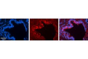 Rabbit Anti-LDHA Antibody  Catalog Number: ARP54777_P050  Formalin Fixed Paraffin Embedded Tissue: Human Bronchial Epithelial Tissue  Observed Staining: Cytoplasmic  Primary Antibody Concentration: 1:100  Secondary Antibody: Donkey anti-Rabbit-Cy3  Secondary Antibody Concentration: 1:200  Magnification: 20X  Exposure Time: 0. (Lactate Dehydrogenase A antibody  (Middle Region))