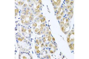 Immunohistochemistry of paraffin-embedded human stomach using TMEM43 antibody (ABIN5974695) at dilution of 1/100 (40x lens). (TMEM43 antibody)