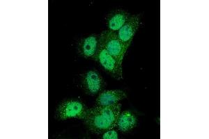 IF analysis of Poliovirus Receptor/PVR using anti-Poliovirus Receptor/PVR antibody (ABIN7601069).