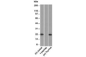 Western blot testing of human Jurkat lysate in the absence and presence of immunizing peptide, and mouse thymus lysate probed with CD3e antibody. (CD3 epsilon antibody)