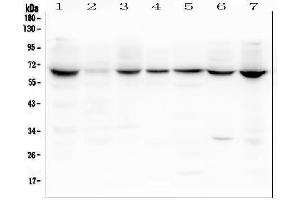 Western blot analysis of LBR using anti-LBR antibody (ABIN6719340).