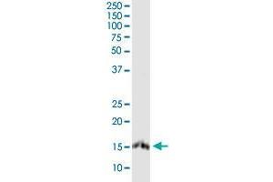 PLP2 monoclonal antibody (M01), clone 2G7. (PLP2 antibody  (AA 1-152))