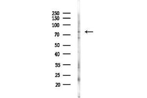 Western blot analysis of lysates from K562 cells(starvation 24h treatment), using GOLGB Antibody at 1/1000 dilution.