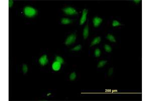 Immunofluorescence of purified MaxPab antibody to STK3 on HeLa cell. (STK3 antibody  (AA 1-491))