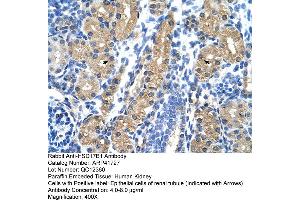 Rabbit Anti-HSD17B1 Antibody  Paraffin Embedded Tissue: Human Kidney Cellular Data: Epithelial cells of renal tubule Antibody Concentration: 4. (HSD17B1 antibody  (N-Term))