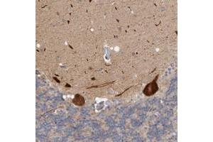 Immunohistochemical staining of human cerebellum with ZNF804B polyclonal antibody  shows strong cytoplasmic positivity in Purkinje cells at 1:200-1:500 dilution. (ZNF804B antibody)