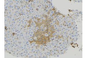 ABIN6274934 at 1/100 staining Mouse liver tissue by IHC-P.