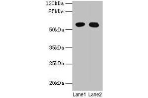 Western blot All lanes: GTPBP6 antibody at 6 μg/mL Lane 1: A549 whole cell lysate Lane 2: Hela whole cell lysate Secondary Goat polyclonal to rabbit IgG at 1/10000 dilution Predicted band size: 57 kDa Observed band size: 57 kDa (GTPBP6 antibody  (AA 146-295))