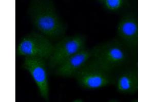 A549 cells were stained with Glycogen synthase 1(S641) (10C1) Monoclonal Antibody  at 1:200 followed by secondary antibody incubation, DAPI staining of the nuclei and detection. (Glycogen Synthase 1 antibody  (pSer641))