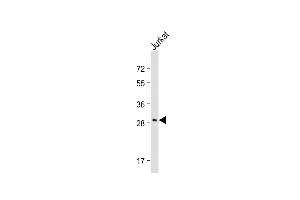 Anti-AQP5 Antibody (C-term) at 1:2000 dilution + Jurkat whole cell lysate Lysates/proteins at 20 μg per lane. (Aquaporin 5 antibody  (C-Term))