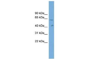 WB Suggested Anti-SLC22A10 Antibody Titration: 0. (SLC22A10 antibody  (Middle Region))