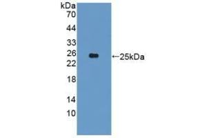 Detection of Recombinant CYP26A1, Human using Polyclonal Antibody to Cytochrome P450 26A1 (CYP26A1) (CYP26A1 antibody  (AA 73-255))