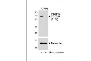 Western blot analysis of lysates from  cell line, untreated or treated with Alkaline phosphatase, 1h, using 459085101 A (upper) or Beta-actin (lower). (CDC25A antibody  (pSer124))