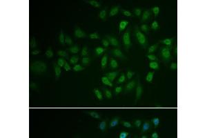 Immunofluorescence analysis of U2OS cells using MYLK3 Polyclonal Antibody