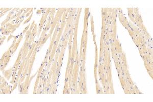 Detection of CACNa1C in Mouse Cardiac Muscle Tissue using Polyclonal Antibody to Calcium Channel, Voltage Dependent, L-Type, Alpha 1C Subunit (CACNa1C) (CACNA1C antibody  (AA 1978-2139))
