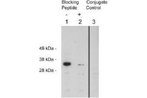 Image no. 1 for anti-Four and A Half LIM Domains 2 (FHL2) antibody (ABIN265171)
