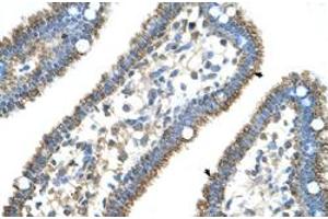Immunohistochemical staining (Formalin-fixed paraffin-embedded sections) of human intestine with CPS1 polyclonal antibody  at 4-8 ug/mL working concentration. (CPS1 antibody  (N-Term))