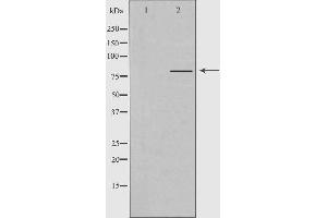 Western blot analysis of extracts from Jurkat cells, using PJA2 antibody.