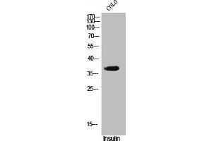 Western Blot analysis of COLO cells using Phospho-VDR (S51) Polyclonal Antibody (Vitamin D Receptor antibody  (pSer51))