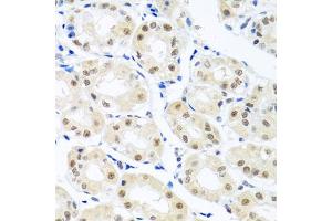 Immunohistochemistry of paraffin-embedded human stomach using THOC1 antibody (ABIN5974800) at dilution of 1/100 (40x lens). (THOC1 antibody)