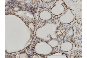 Immunoperoxidase of monoclonal antibody to SFPQ on formalin-fixed paraffin-embedded human thyroid nodular goiter. (SFPQ antibody  (AA 269-361))