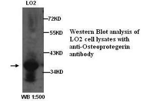Image no. 2 for anti-Tumor Necrosis Factor Receptor Superfamily, Member 11b (TNFRSF11B) antibody (ABIN790903) (Osteoprotegerin antibody)