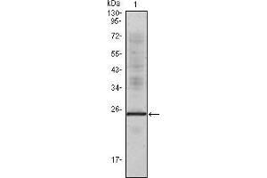 Western blot analysis using IL1a mouse mAb against truncated IL1a recombinant protein.