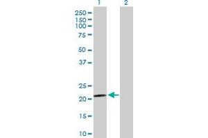 Western Blot analysis of PARK7 expression in transfected 293T cell line by PARK7 MaxPab polyclonal antibody. (PARK7/DJ1 antibody  (AA 1-189))