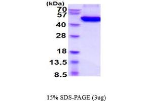 SDS-PAGE (SDS) image for Tumor Necrosis Factor Receptor Superfamily, Member 11b (TNFRSF11B) (AA 22-401) protein (His tag) (ABIN5854580) (Osteoprotegerin Protein (AA 22-401) (His tag))