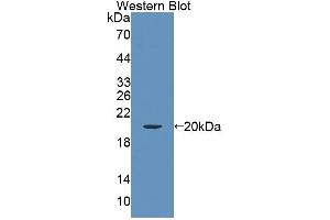 Figure. (Endothelin 3 antibody  (AA 20-167))
