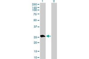 Western Blot analysis of UROS expression in transfected 293T cell line by UROS MaxPab polyclonal antibody.