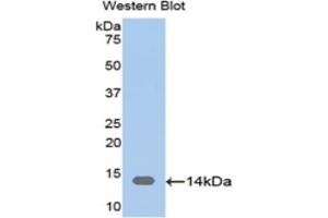 Detection of Recombinant CAP1, Human using Polyclonal Antibody to Adenylyl Cyclase Associated Protein 1 (CAP1) (CAP1 antibody  (AA 38-149))