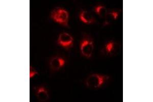 Immunofluorescent analysis of BCL10 staining in A549 cells. (BCL10 antibody)