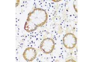 Immunohistochemistry of paraffin-embedded human stomach using CaMKI antibody (ABIN7266017) at dilution of 1:100 (40x lens). (CAMK1 antibody  (AA 1-93))