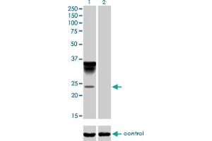 Western blot analysis of ORM1 over-expressed 293 cell line, cotransfected with ORM1 Validated Chimera RNAi (Lane 2) or non-transfected control (Lane 1).