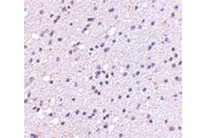 Immunohistochemistry of CADPS2 in human brain with CADPS2 polyclonal antibody  at 5 ug/mL .