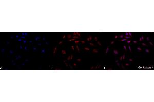 Immunocytochemistry/Immunofluorescence analysis using Mouse Anti-Hsp47 Monoclonal Antibody, Clone 1C4-1A6 . (SERPINH1 antibody  (FITC))