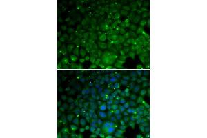 Immunofluorescence analysis of HeLa cells using CRYAA antibody (ABIN5973354). (CRYAA antibody)
