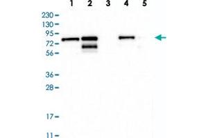 Western blot analysis of Lane 1: RT-4, Lane 2: U-251 MG, Lane 3: Human Plasma, Lane 4: Liver, Lane 5: Tonsil with TMTC2 polyclonal antibody  at 1:250-1:500 dilution. (TMTC2 antibody)